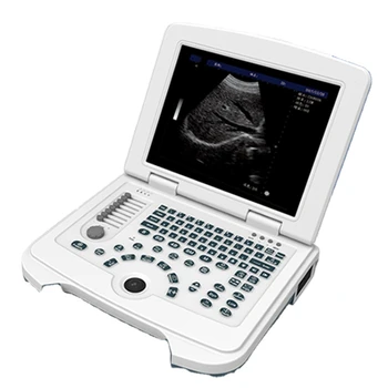 портативный ультразвуковой сканер для ноутбука в акушерстве и гинекологии по специальной цене